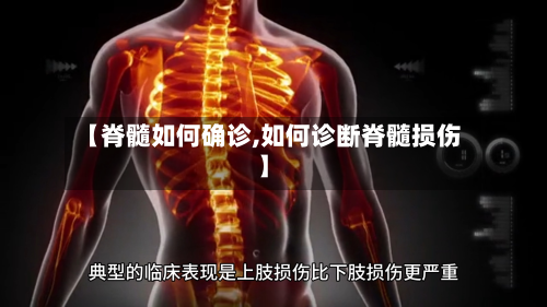 【脊髓如何确诊,如何诊断脊髓损伤】-第2张图片