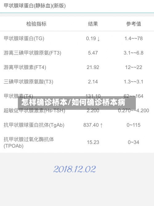 怎样确诊桥本/如何确诊桥本病-第2张图片