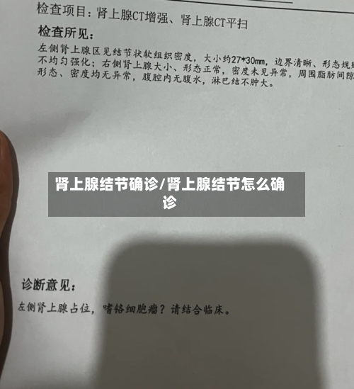 肾上腺结节确诊/肾上腺结节怎么确诊