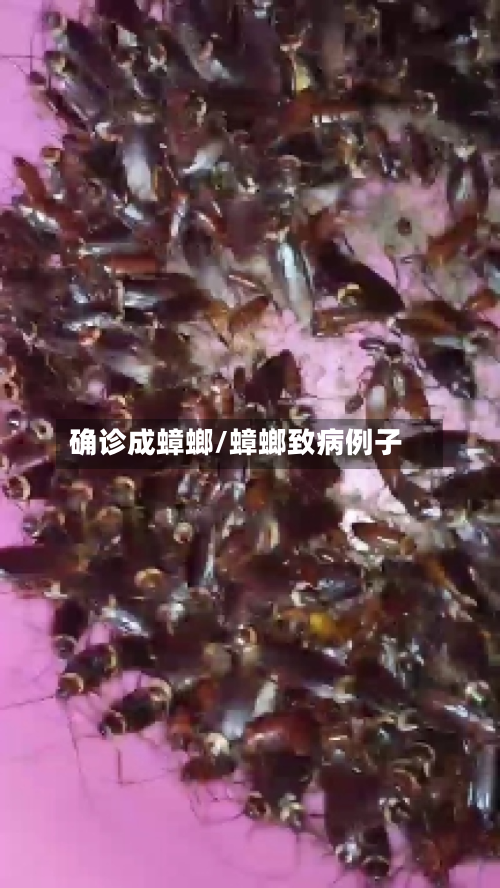 确诊成蟑螂/蟑螂致病例子-第2张图片