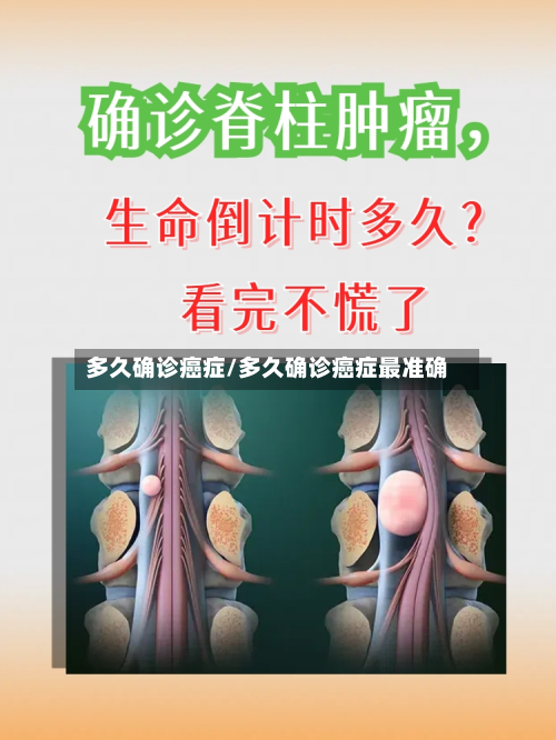 多久确诊癌症/多久确诊癌症最准确-第3张图片