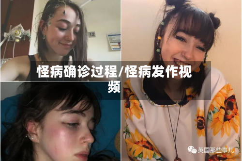 怪病确诊过程/怪病发作视频-第3张图片