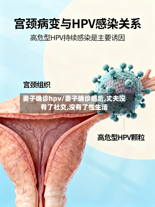妻子确诊hpv/妻子确诊癌后,丈夫没有了社交,没有了性生活
