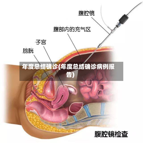 年度总结确诊(年度总结确诊病例报告)