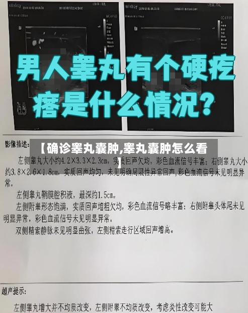 【确诊睾丸囊肿,睾丸囊肿怎么看】-第3张图片