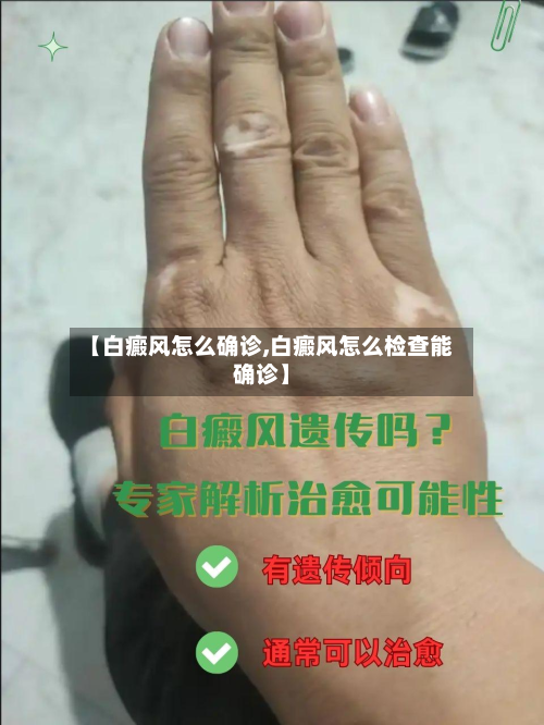 【白癜风怎么确诊,白癜风怎么检查能确诊】-第3张图片
