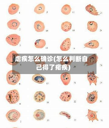 虐疾怎么确诊(怎么判断自己得了疟疾)