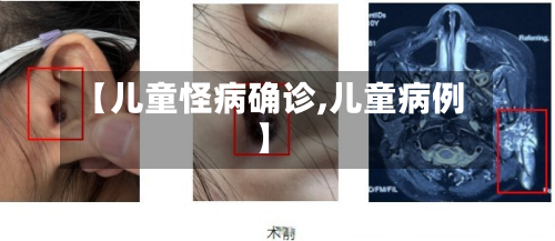 【儿童怪病确诊,儿童病例】-第2张图片