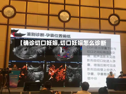 【确诊切口妊娠,切口妊娠怎么诊断】-第3张图片