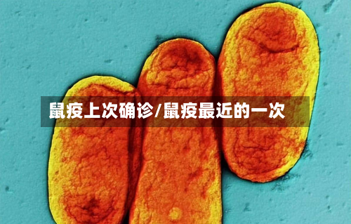 鼠疫上次确诊/鼠疫最近的一次-第3张图片