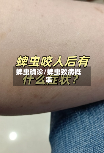 蜱虫确诊/蜱虫致病概率-第3张图片