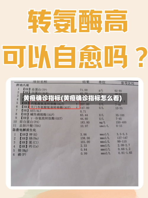 黄疸确诊指标(黄疸确诊指标怎么看)