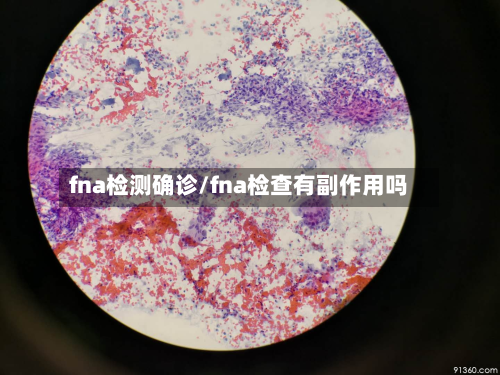 fna检测确诊/fna检查有副作用吗