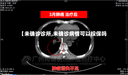 【未确诊诊所,未确诊病情可以投保吗】